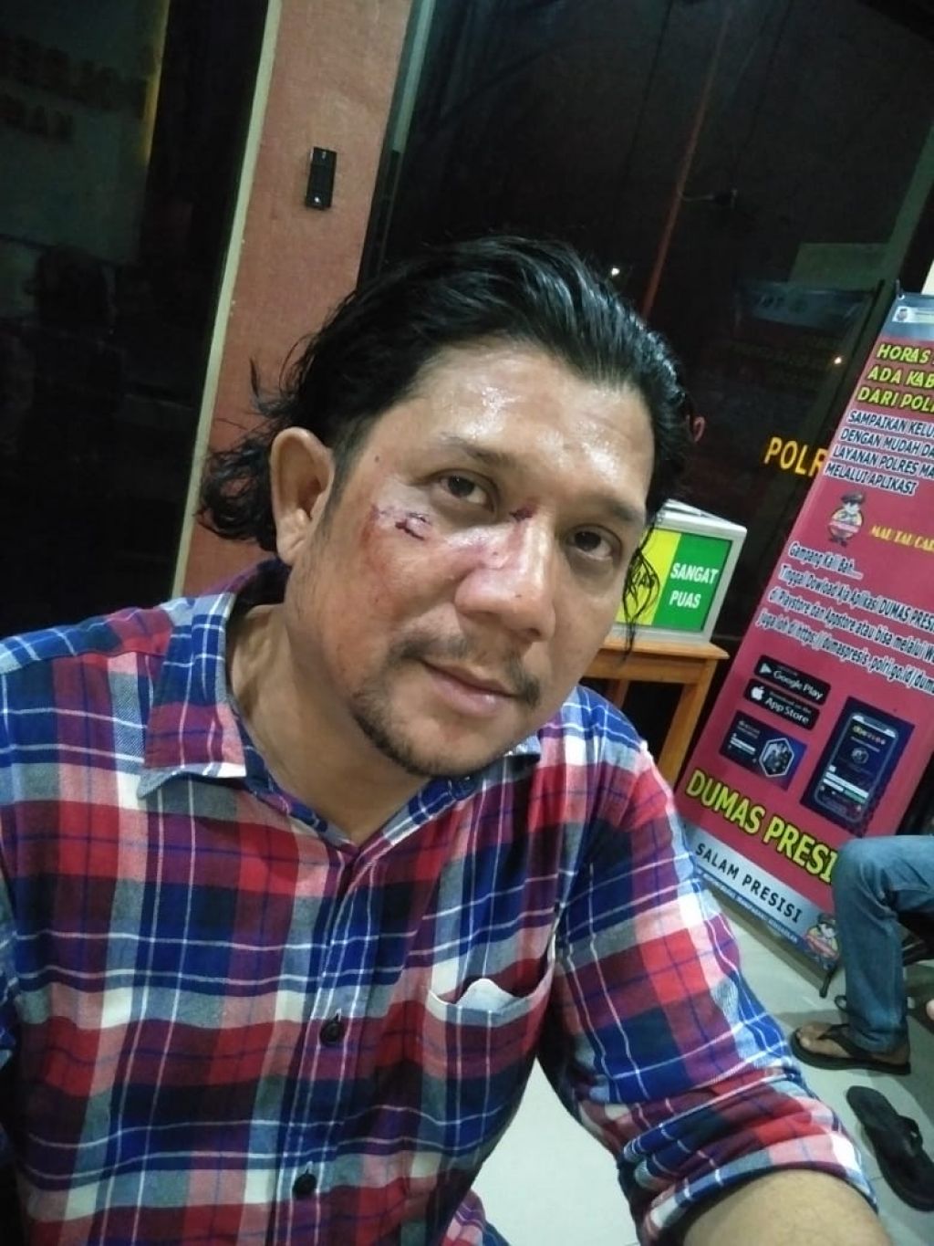 Jeffry Barata Lubis saat melapor ke polisi terkait penganiayaan yang dia alami