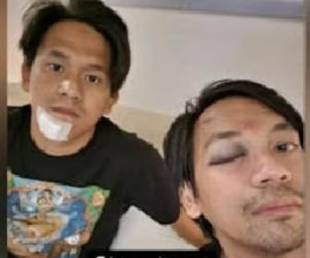 Kondisi Rian dan Tomi usai kecelakaan.